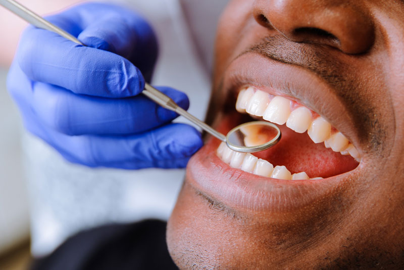 dental bonding patient