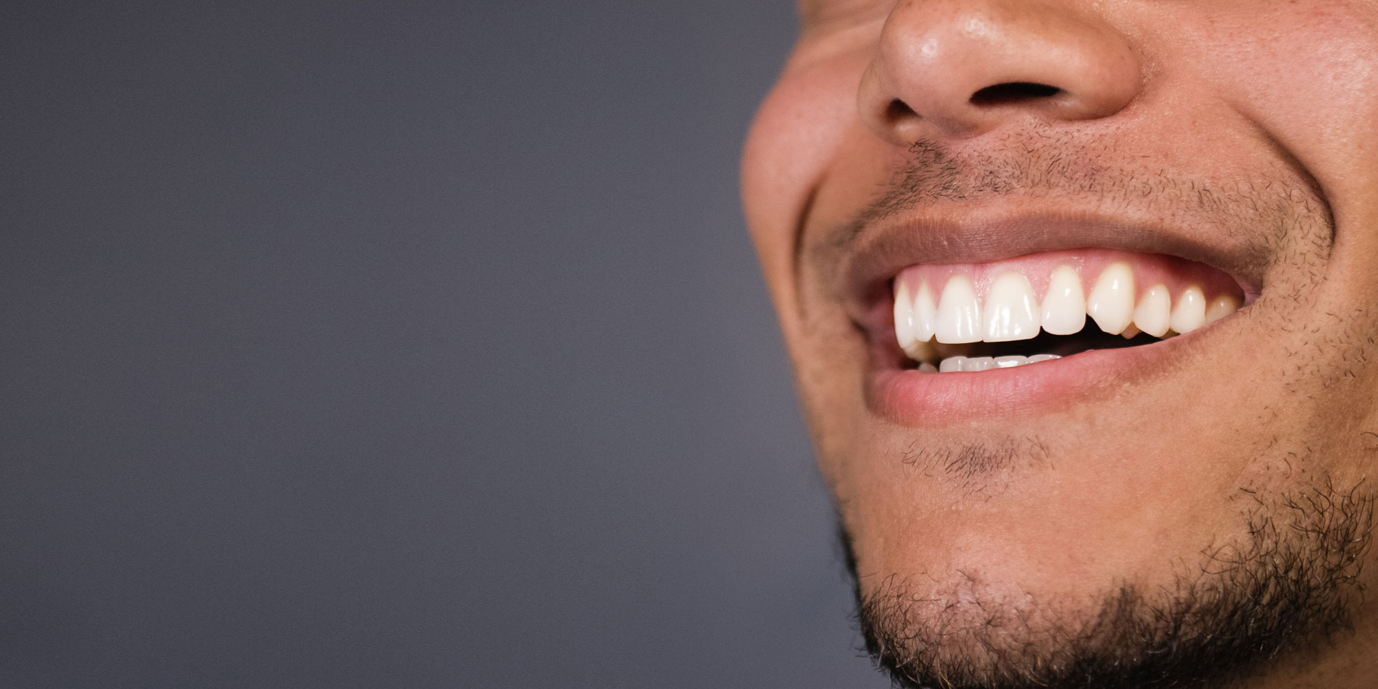 dental patient in need of gum grafting procedure.