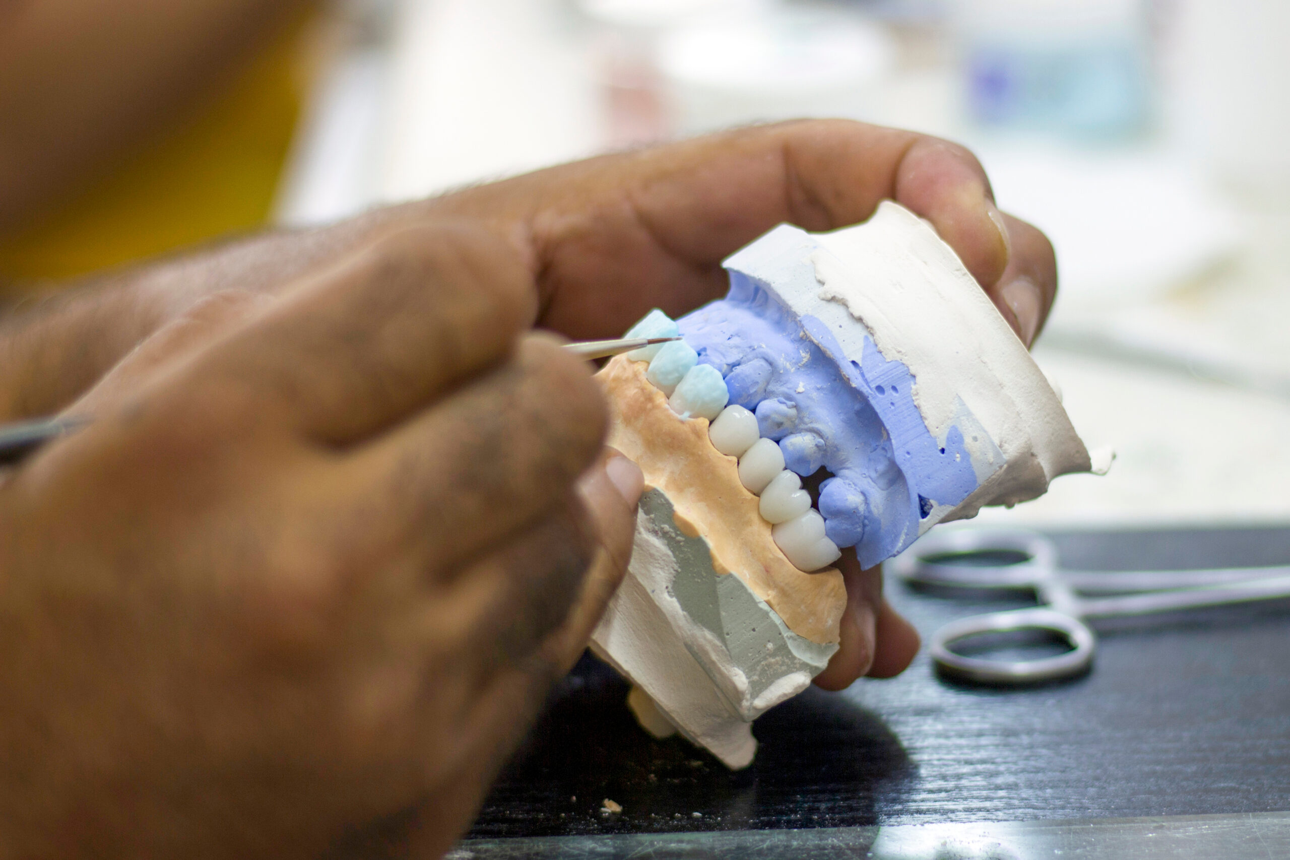a full mouth dental implant model being worked on by a dentist.