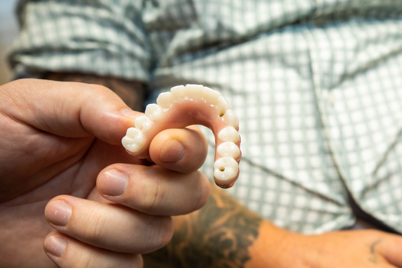 Dr James Wright III Holding A Full Mouth Dental Implant Prosthesis